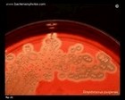 S.pyogenes